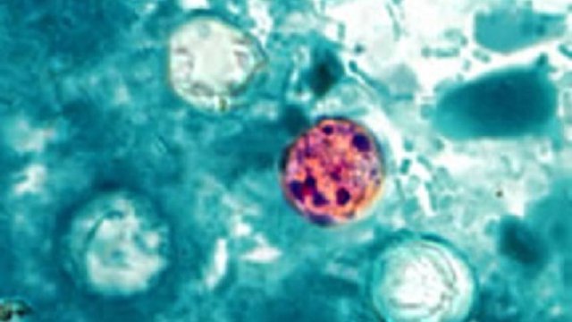 McDonald's salad parasite at center of FDA-CDC probe